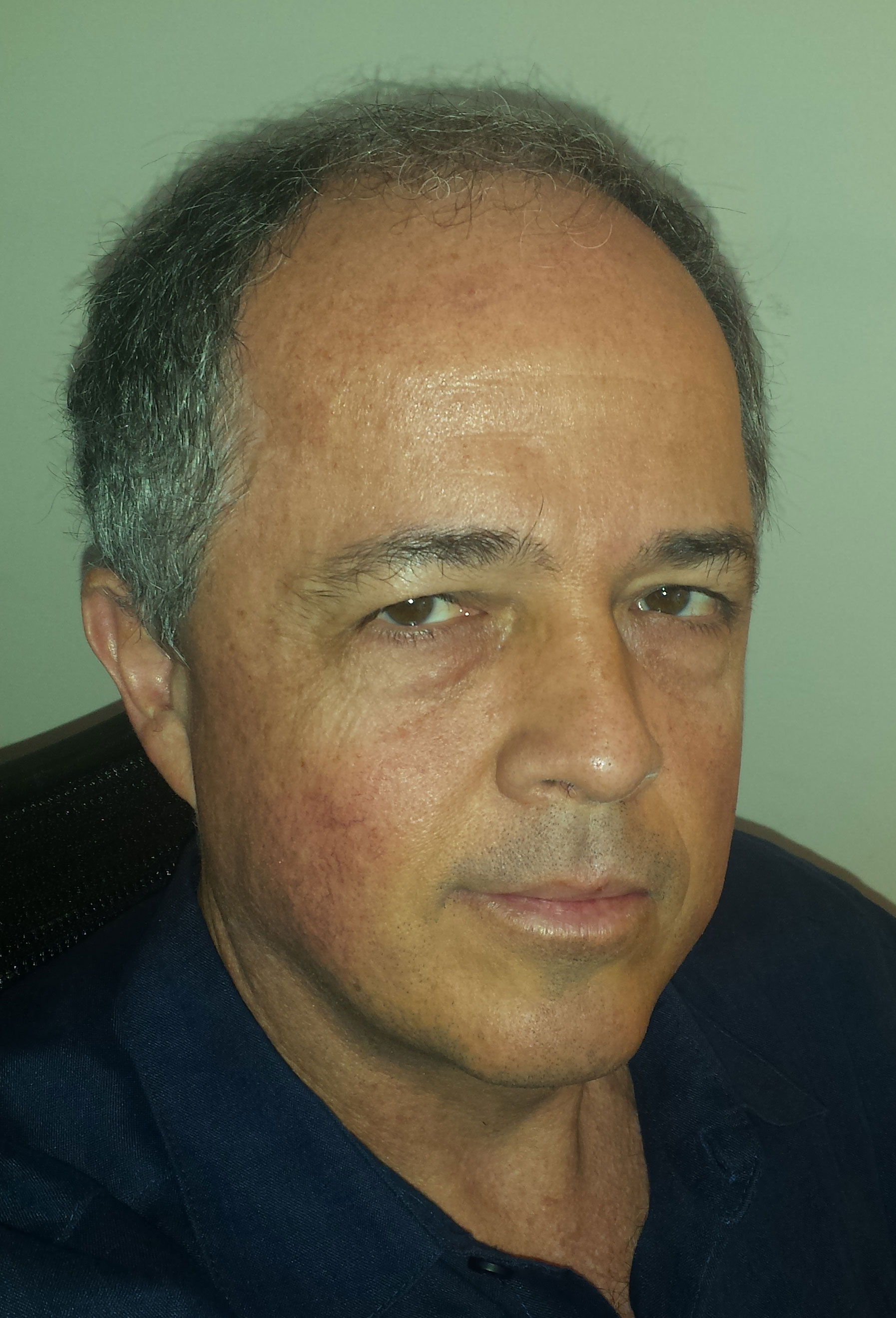 Harald Bindeus