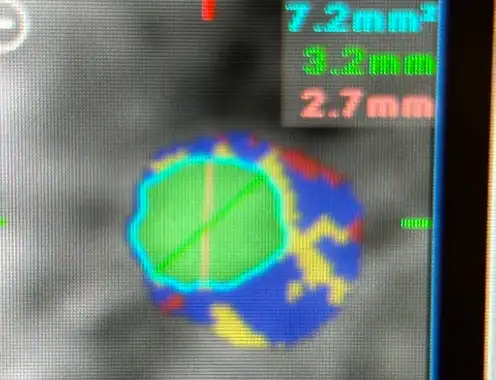 Innovative approach to chest pain evaluation for traveler
